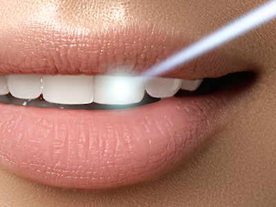 Rosenthal Dental Group | Invisalign reg , Dentures and The Waterlase   Laser from Biolase