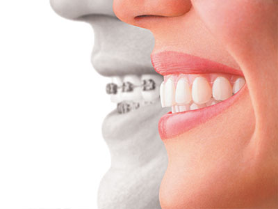 Rosenthal Dental Group | Root Canals, Night Guards and Dental Bridges