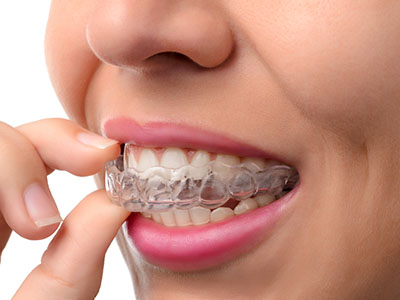 Rosenthal Dental Group | Invisalign reg , Implant Dentistry and Pediatric Dentistry